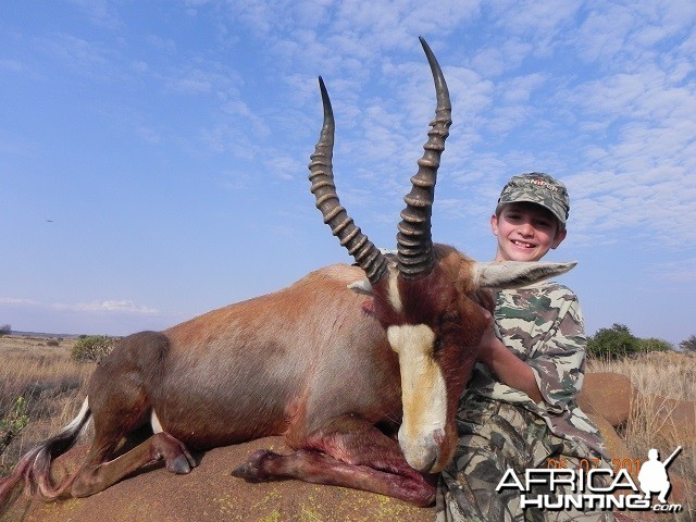 Blesbok