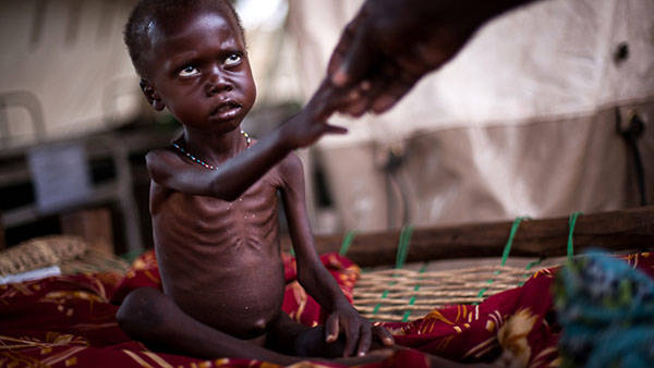 600x338q70Starving-African-Child.jpg