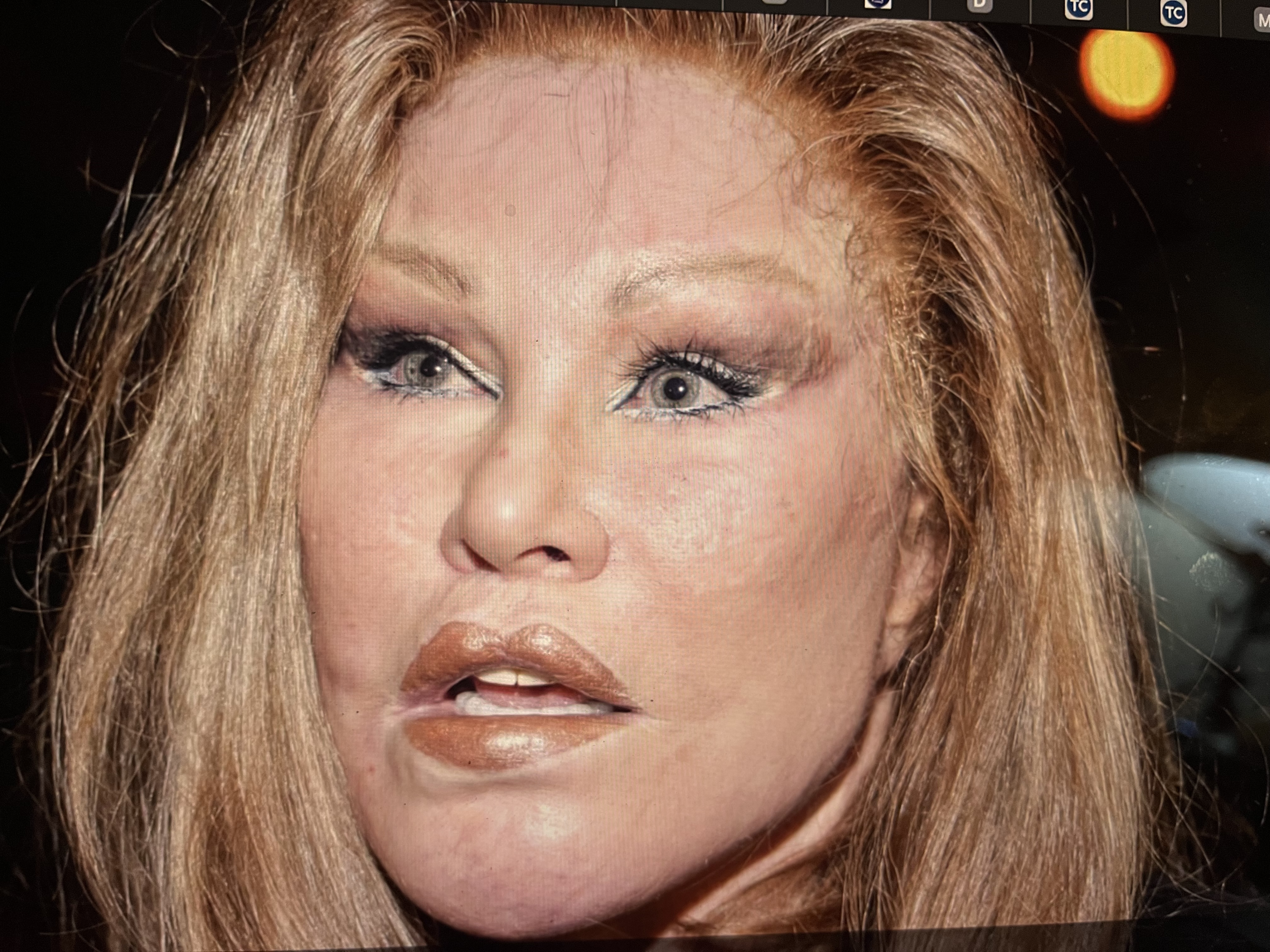 PLASTIC SURGERY.jpg