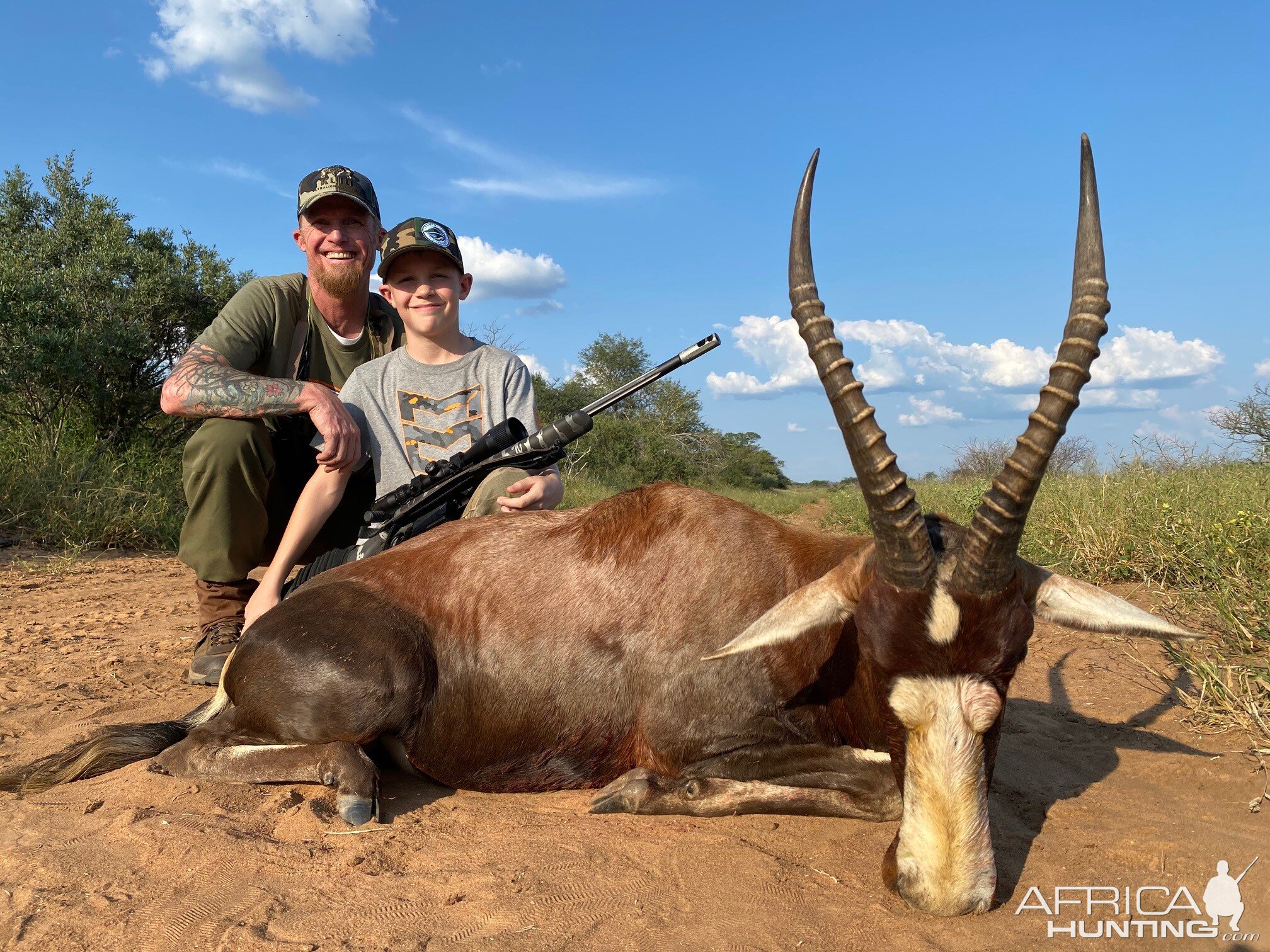 Blesbok Hunt South Africa